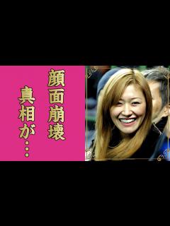 [x]KEIKOが顔面崩壊した真相...鼻が壊死した原因に言葉を失う...『globe』のヴォーカリストが手にした巨額の離婚慰謝料...ドリル生活の ...