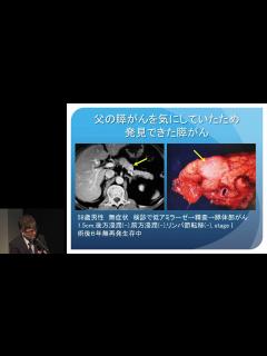 [x]すい臓がん“すい臓がんに対する外科治療の進歩” 中郡 聡夫 - YouTube