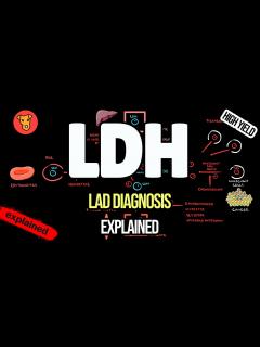 [x]LACTATE DEHYDROGENASE Clinical significance Why LDH increase ? - YouTube