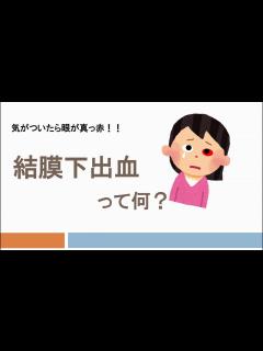 [x]結膜下出血ってなあに - YouTube
